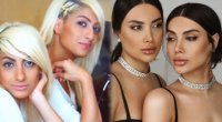Sevil və Sevincin plastik əməliyyatdan əvvəlki halı - VİDEO