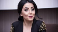 “Botoks məni elə günə qoydu ki, toylarım əldən gedirdi”