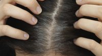 Saçlar niyə vaxtından tez ağarır? - Stresslə əlaqəsi yoxdur