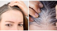 Ağ saçları yox edib yenidən çıxmasını əngəlləyən 9 TƏBİİ VASİTƏ
