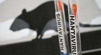 ÜST-dən hantavirus AÇIQLAMASI: Pandemiya geri qayıdır?