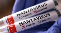 Hantavirus Ukraynaya çatdı &ndash; Ölənlər var