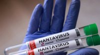 Hantavirusun hansı heyvandan keçdiyi BİLİNDİ &ndash; Bu ölkələrdə olur - FOTO