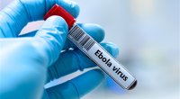 Ölümcül virus üç ölkəyə YAYILDI &ndash; Giriş MƏHDUDLAŞDIRILIR
