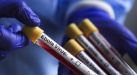 Ebola ilə bağlı HƏYƏCAN TƏBİLİ &ndash; Vəziyyət daha da ağırlaşır