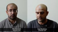 Məktəb direktorunun avtomobilini yandıran daha bir nəfər həbs edildi &ndash; VİDEO