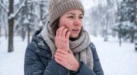 Soyuğa olan allergiyası qadının həyatını dəyişdirdi &ndash; Dondurma yeyə bilmir, evdən çıxmaqdan qorxur