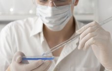 Bu xəstəlikləri ağız suyu ilə bir saata müəyyən etmək MÜMKÜN OLACAQ