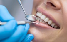 Azərbaycanda 74 stomatoloq qanunsuz fəaliyyət göstərirmiş