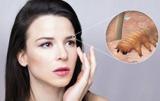 Sinir sistemini məhv edən HƏŞƏRAT - Havalar istiləşdikcə artırlar