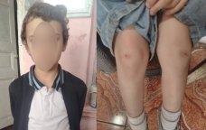 İki şagirdin məktəbin ayaqyolunda mütəmadi döyülməsi ilə bağlı RƏSMİ AÇIQLAMA