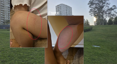 “Mərkəzi Park”da 2 yaşlı uşaq kanalizasiya quyusuna düşdü - Fotolar