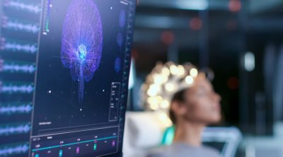 Alzheimer xəstəliyini 3 dəqiqəyə aşkar edən üsul tapıldı
