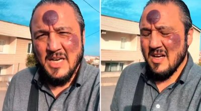 Üzünə hicama etdirən kişi görün nə HALA düşdü – VİDEO