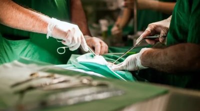 35 il mədəsində udduğu alışqanla gəzdi - FOTO