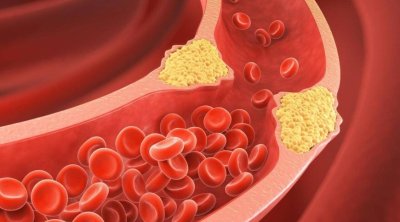 Xolesterini azaldan meyvə - Kilosu 1 manat 50 qəpikdir