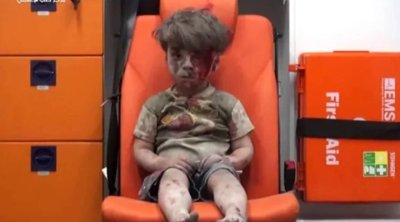 9 il əvvəl hamını məyus etmişdi - İndiki halı diqqət çəkdi - FOTO