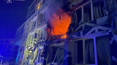 Kiyevdə xəstəxanaya zərbə endirildi - Ölən və yaralananlar var - FOTO