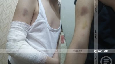 Bakıda məktəbli sinif yoldaşı tərəfindən döyüldü: Kamera niyə işləməyib? - İDDİA - FOTO