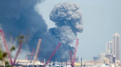 Dubayda xəsarət alan Azərbaycan vətəndaşının SON DURUMU