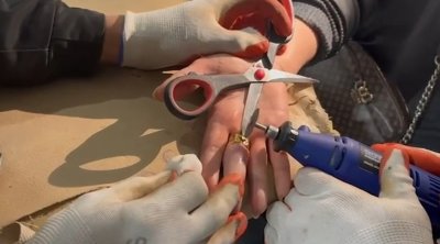 Barmağında sıxışan üzüyü belə çıxardılar – VİDEO