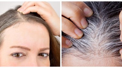 Ağ saçları yox edib yenidən çıxmasını əngəlləyən 9 TƏBİİ VASİTƏ
