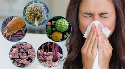 Bu tarixə qədər hər iki insandan birində allergiya olacaq &ndash; ŞOK XƏBƏRDARLIQ