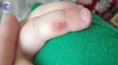 Bakıda tərbiyəçi 3 yaşlı uşağın əlinə dağ basıb &ndash; İDDİA/VİDEO