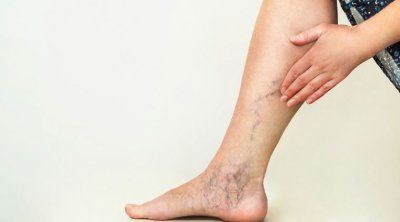 Özünüzdə tromb olub-olmamasını NECƏ BİLƏK?