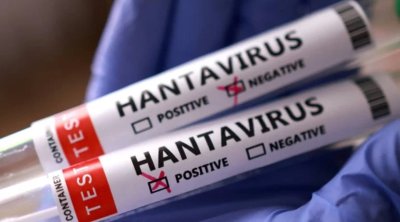 Venesuelada hantavirus həyəcanı: Ölənlər var