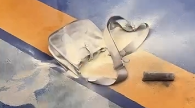 Anar Ağakişiyevin çantasında “powerbank” partladı - Xəsarətlər aldı - VİDEO