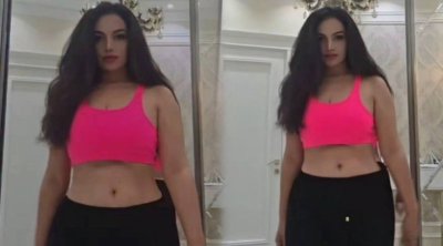 Plastik əməliyyatdan sonrakı halını nümayiş etdirdi – VİDEO