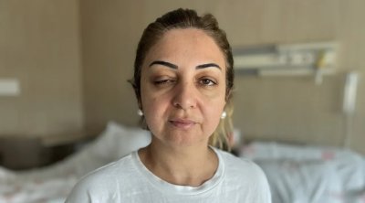 3 qadın botoksdan sonra xəstəxanaya yerləşdirildi: Danışmaqda və görməkdə çətinlik çəkirlər &ndash; FOTO/VİDEO
