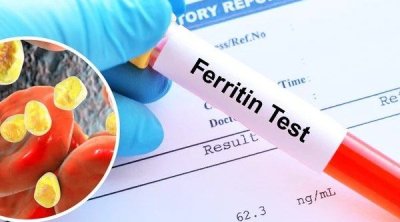 Əksəriyyətin ferritin haqqında bilmədiyi VACİB MƏLUMAT