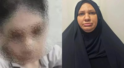 Bacısı oğluna işgəncə verən falçının məhkəməsi: "Hər dəfə uşaq deyirdi ki, pişik cırmaqlayıb"