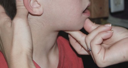 “Çöp” qalma MİFİ – Müasir tibb YOX, xalq ÜSULU?