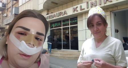 Ölüm saçan “MedAura” klinikası - Uğursuz əməliyyatlara səbəb olan Nigar Məhəmmədova iş başındadır? - ARAŞDIRMA