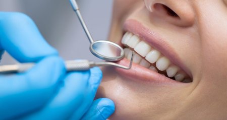 Azərbaycanda 74 stomatoloq qanunsuz fəaliyyət göstərirmiş