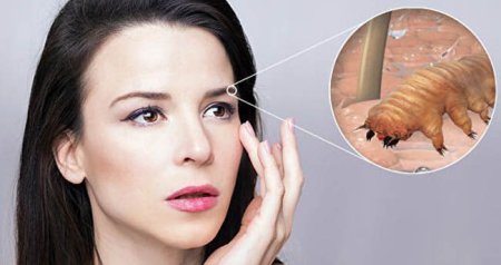 Sinir sistemini məhv edən HƏŞƏRAT - Havalar istiləşdikcə artırlar