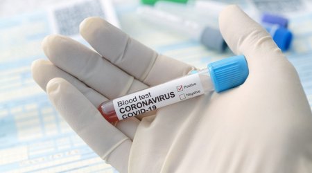 Azərbaycanda koronavirusa yoluxma sayı yenə 2000-i keçdi