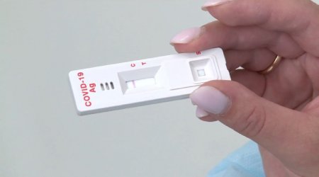 Azərbaycan koronavirusun aşkarlanması üçün istifadə olunan ekspress testlərdən imtina etdi