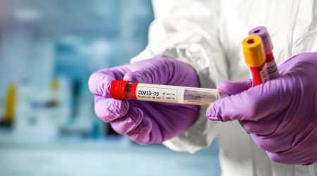 ''Kifayət kədər koronavirus testi ehtiyatı var'' - Agentlik
