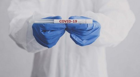 Dünyanın 2021-ci ilin yanvarın 1-nə olan COVİD-19 statistikası