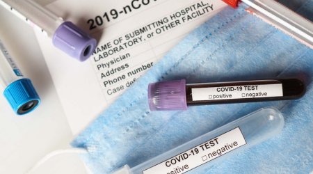 Türkiyədə koronavirusdan 144 nəfər həyatını itirdi