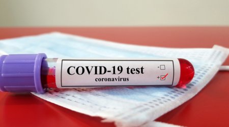 COVİD-19-a yoluxanların sayı 100 milyonu ötdü