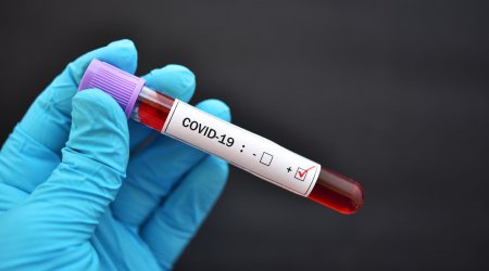 ÜST dünyada koronavirusa yoluxanların sayını açıqladı