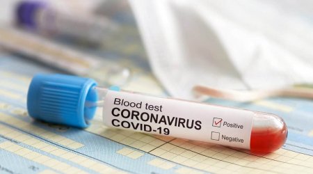 Bakıda 5 müəllim və 1 uşaqda koronavirus tapıldı