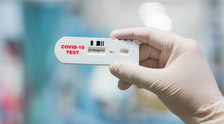 Azərbaycanda indiyədək 246 304 nəfər koronavirus infeksiyasına yoluxub