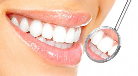 Ev şəraitində dişləri ağartmağın 8 ASAN ÜSULU 