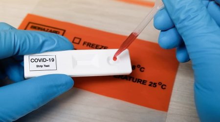 Vaksin olunmayanlara COVİD-19 testləri qadağan ediləcək